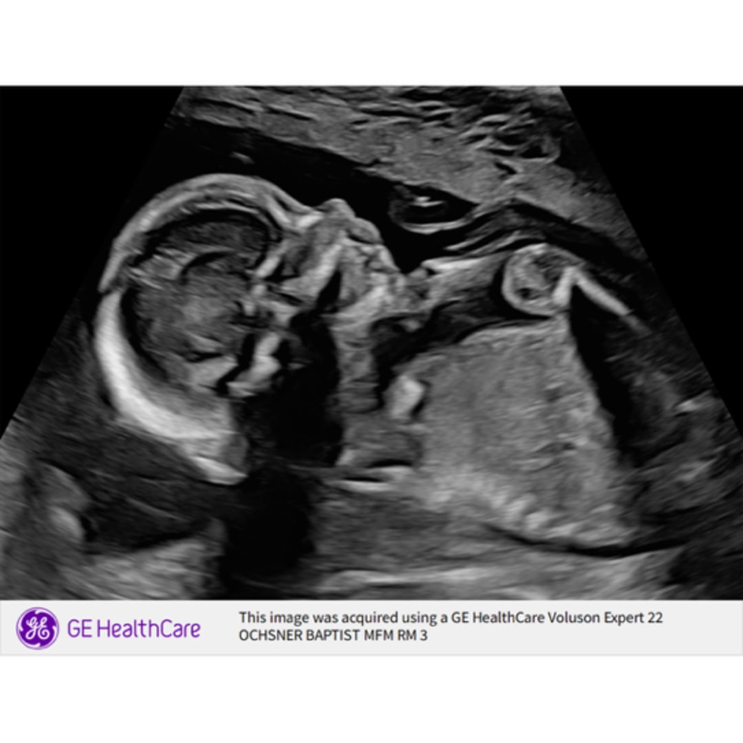 Photo shared by Yasia for their Babylist baby registry.