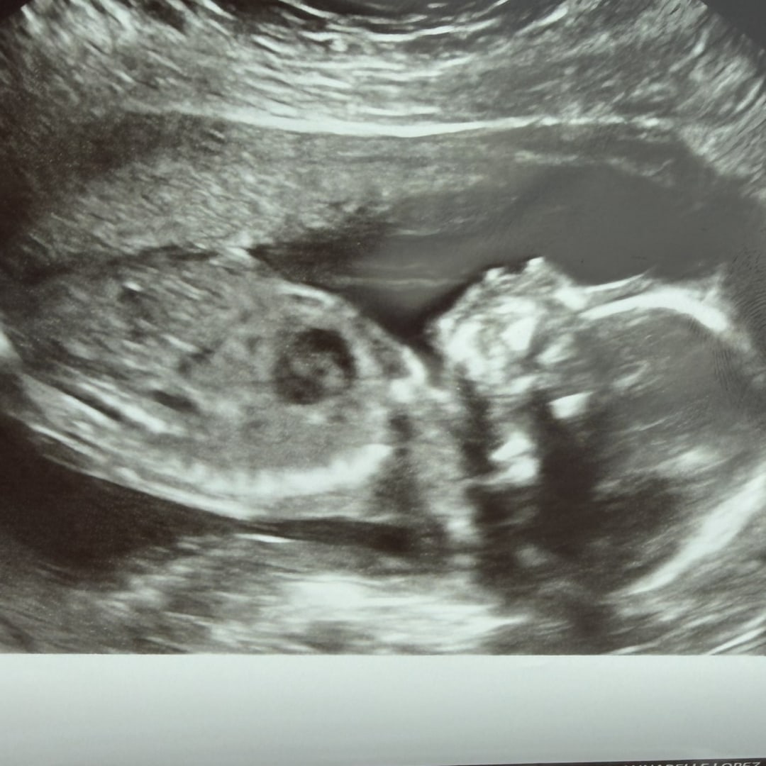 Photo shared by Isabella for their Babylist baby registry.