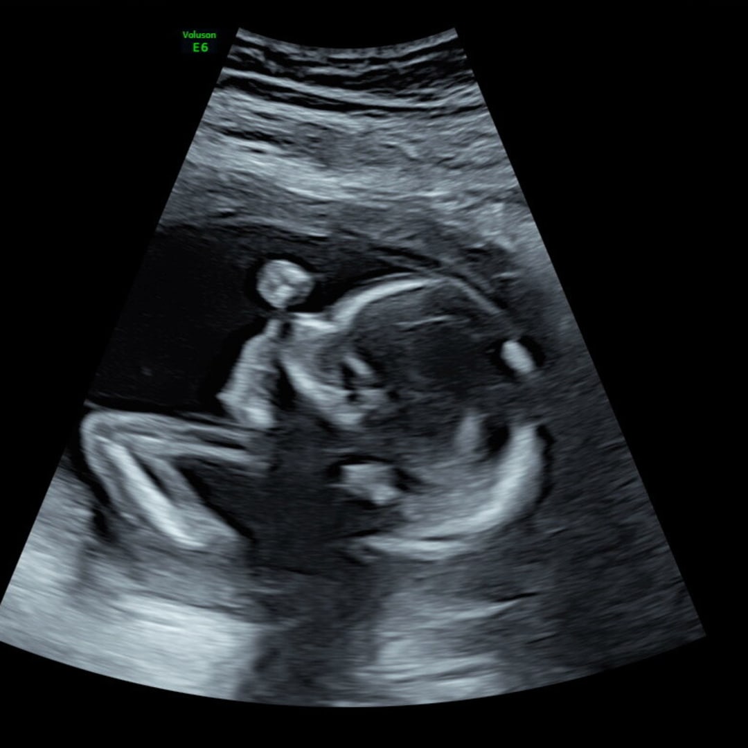 Photo shared by Faith for their Babylist baby registry.
