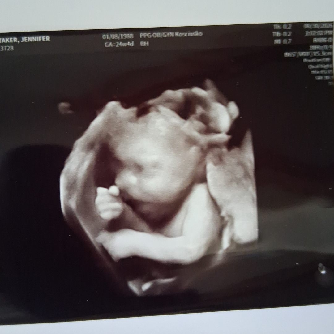 Photo shared by Jennifer for their Babylist baby registry.