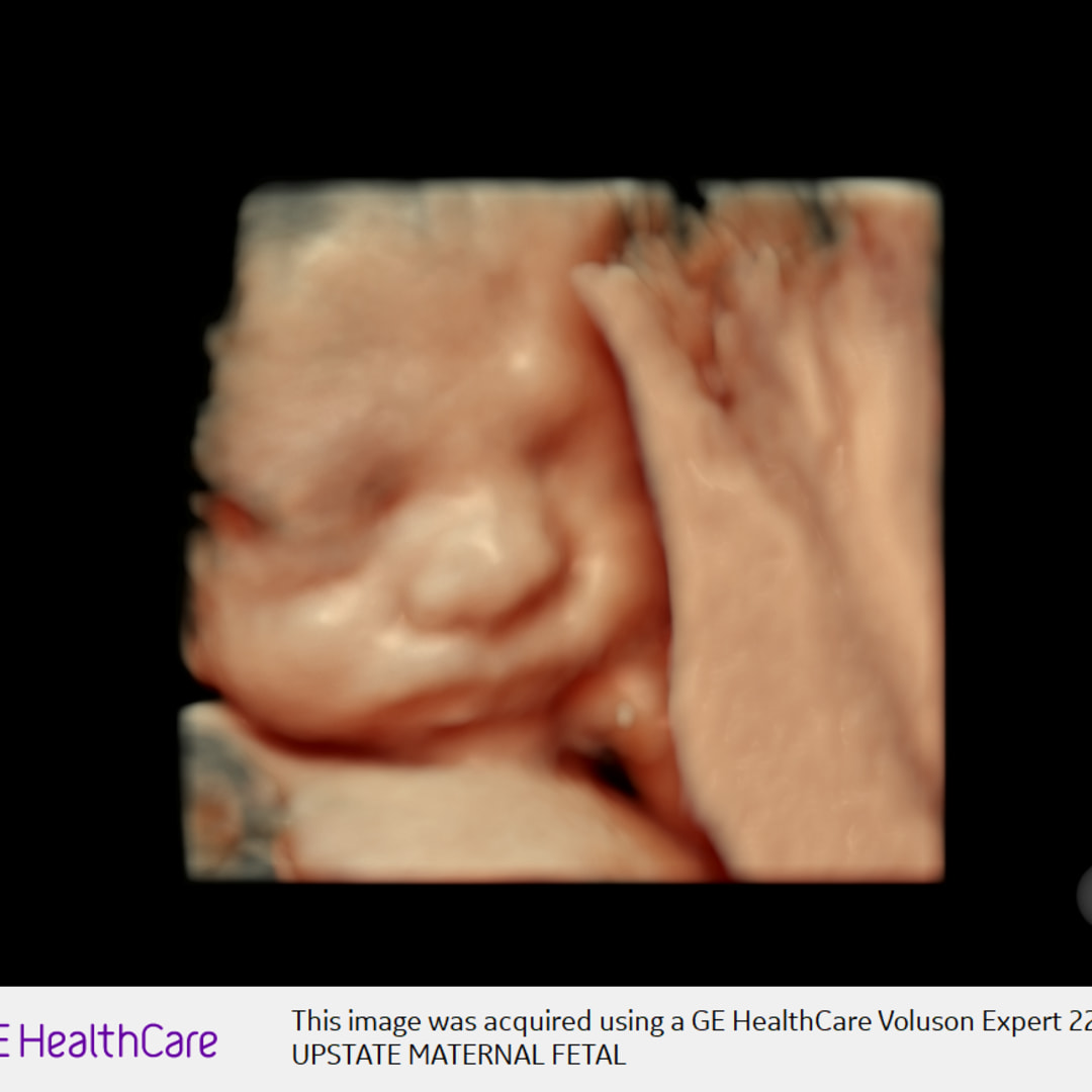 Photo shared by Stephanie for their Babylist baby registry.