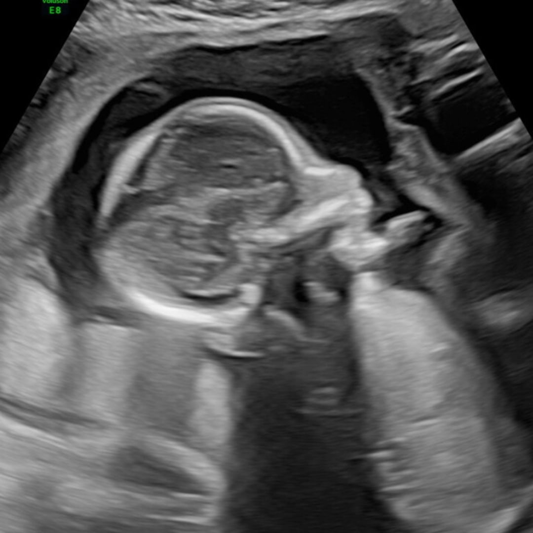 Photo shared by Jaiden for their Babylist baby registry.