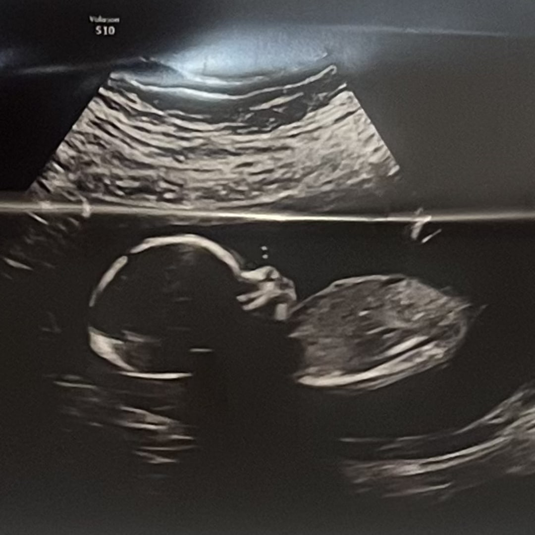 Photo shared by Brittany for their Babylist baby registry.