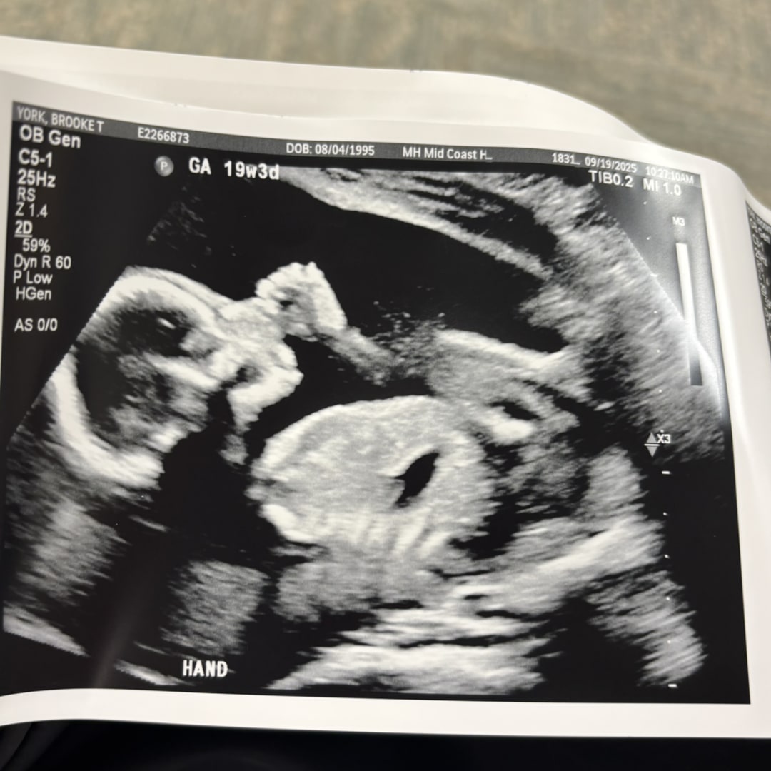 Photo shared by Brooke for their Babylist baby registry.