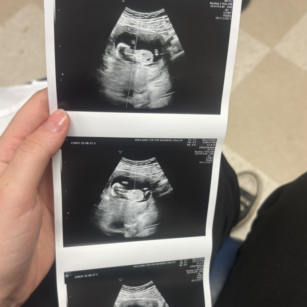 Photo shared by Rosie for their Babylist baby registry.