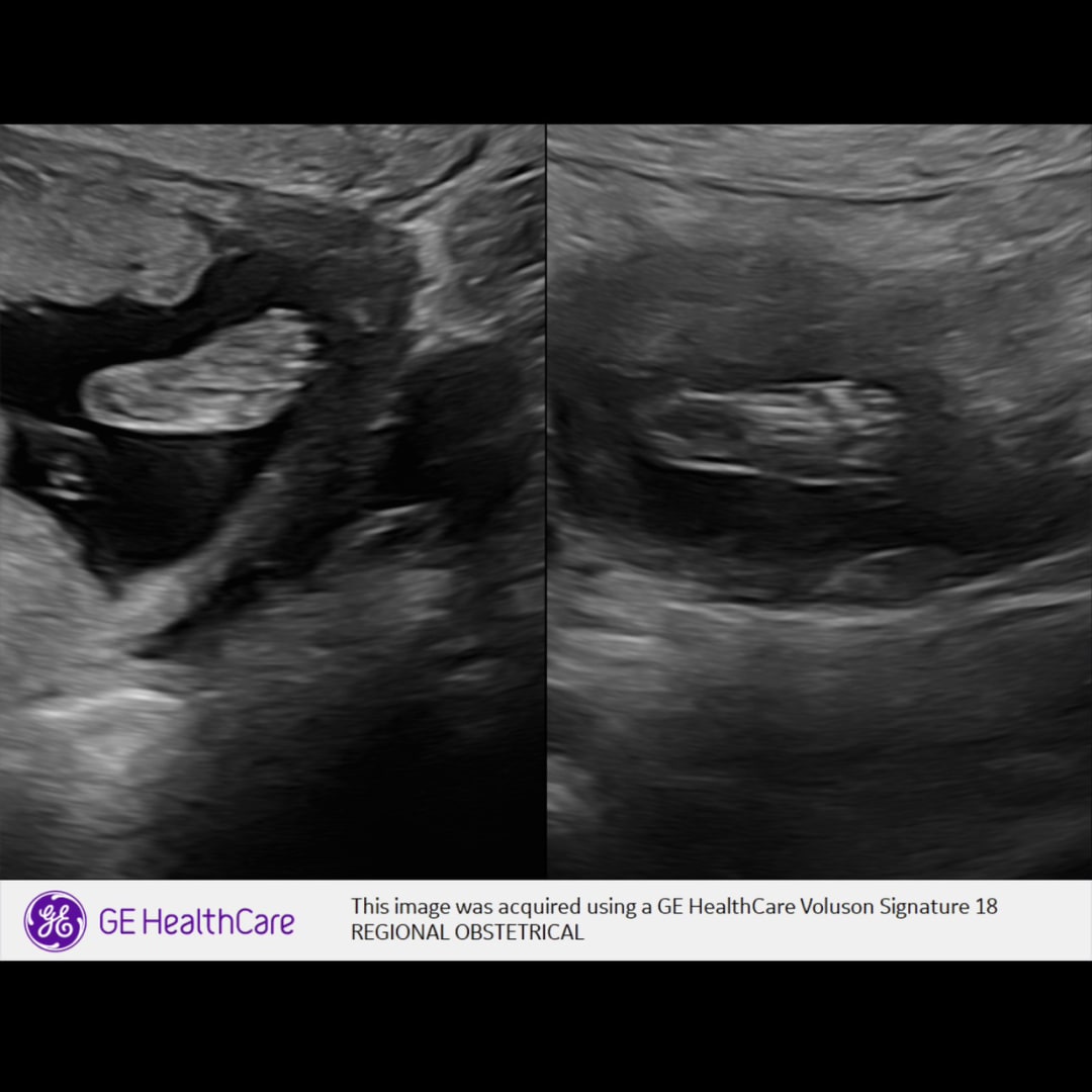 Photo shared by Abbi for their Babylist baby registry.