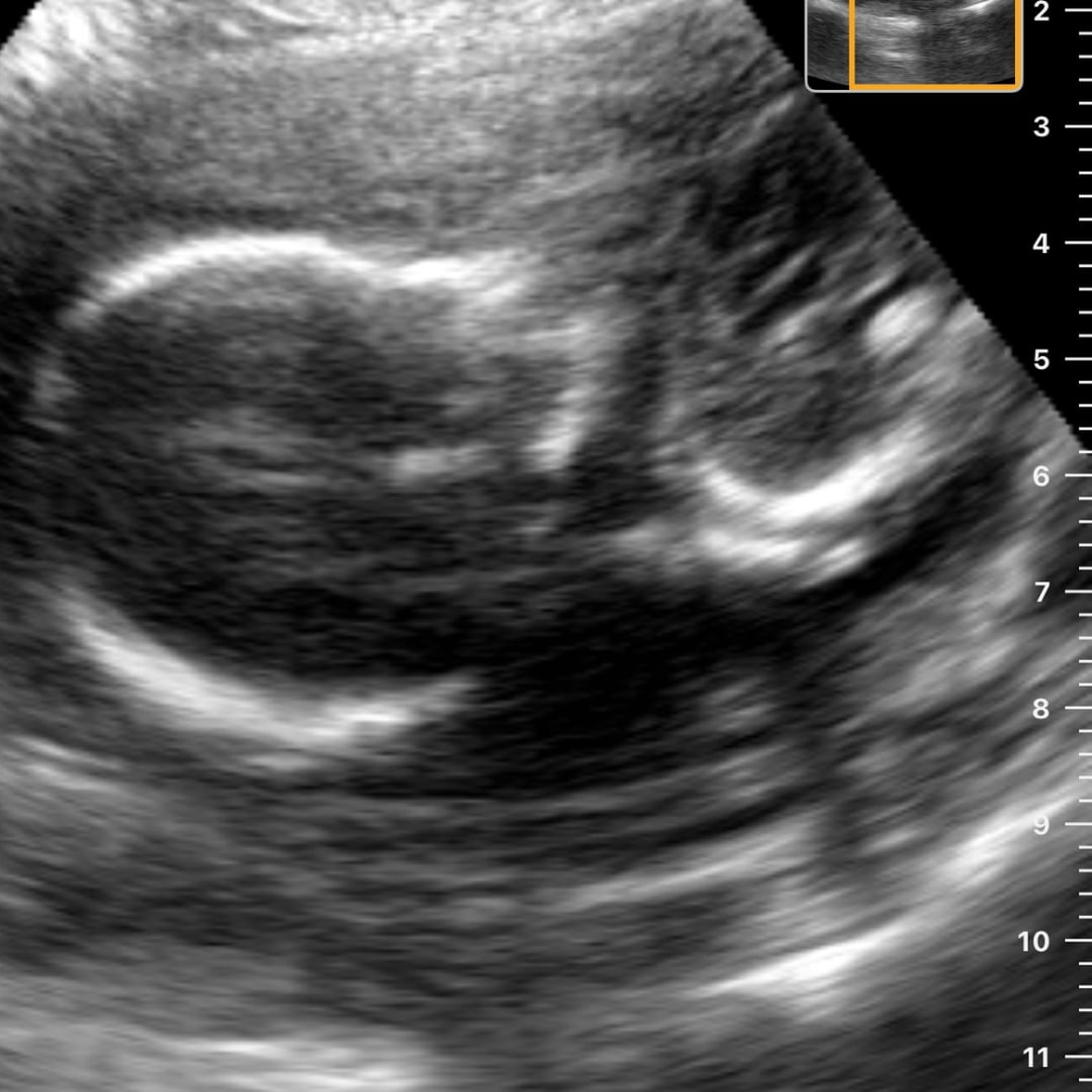 Photo shared by Helen for their Babylist baby registry.