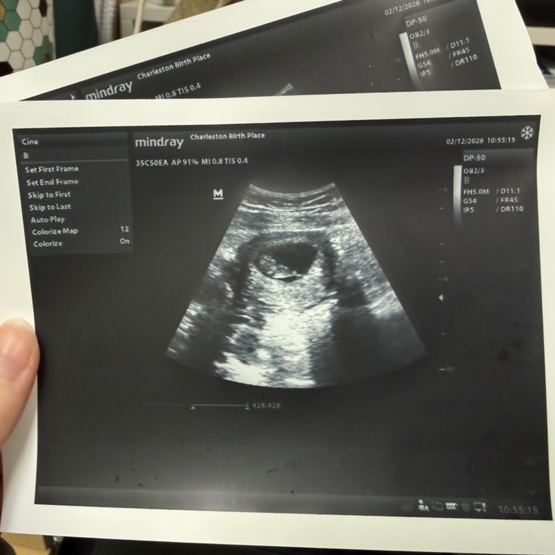 Photo shared by Claire for their Babylist baby registry.