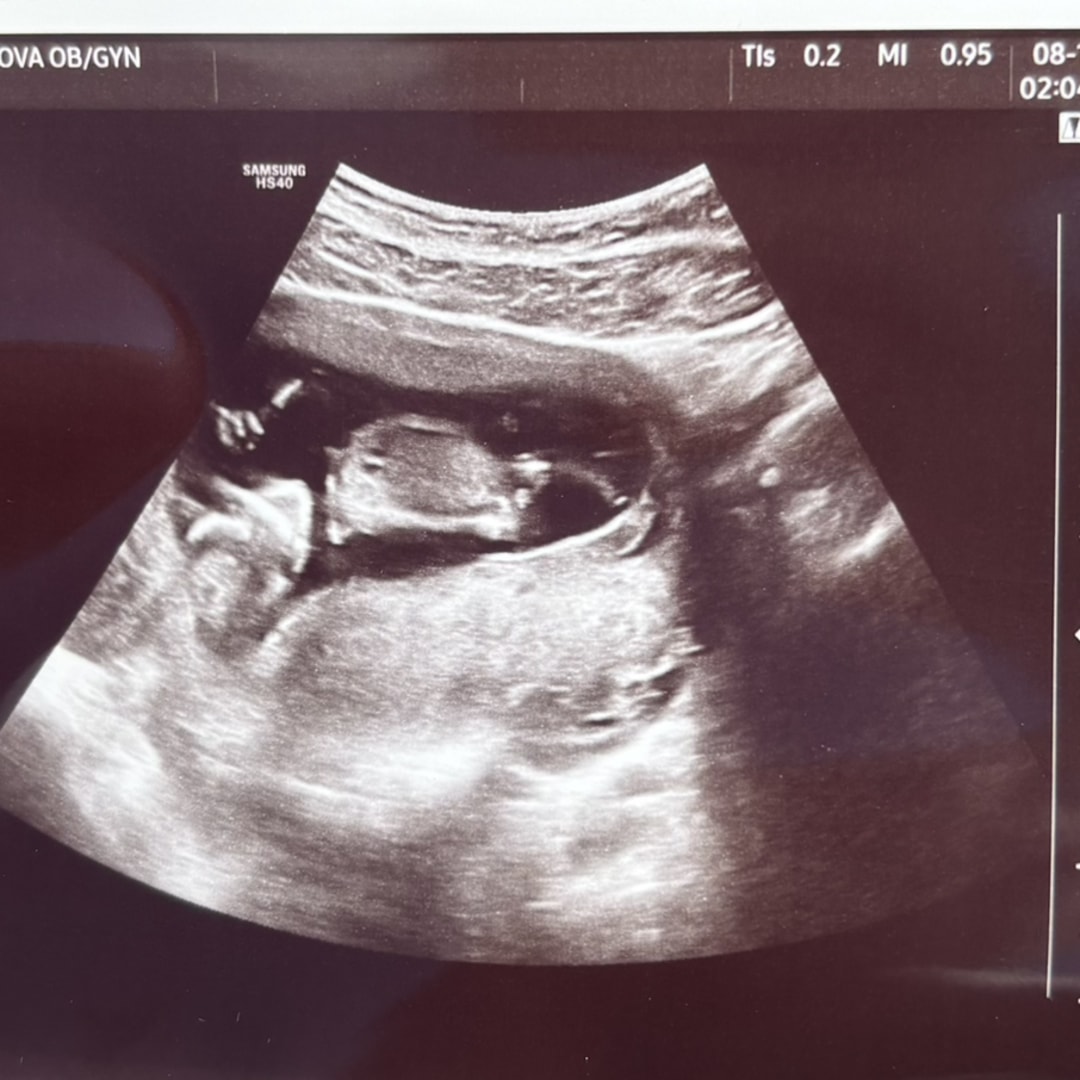 Photo shared by Annie for their Babylist baby registry.