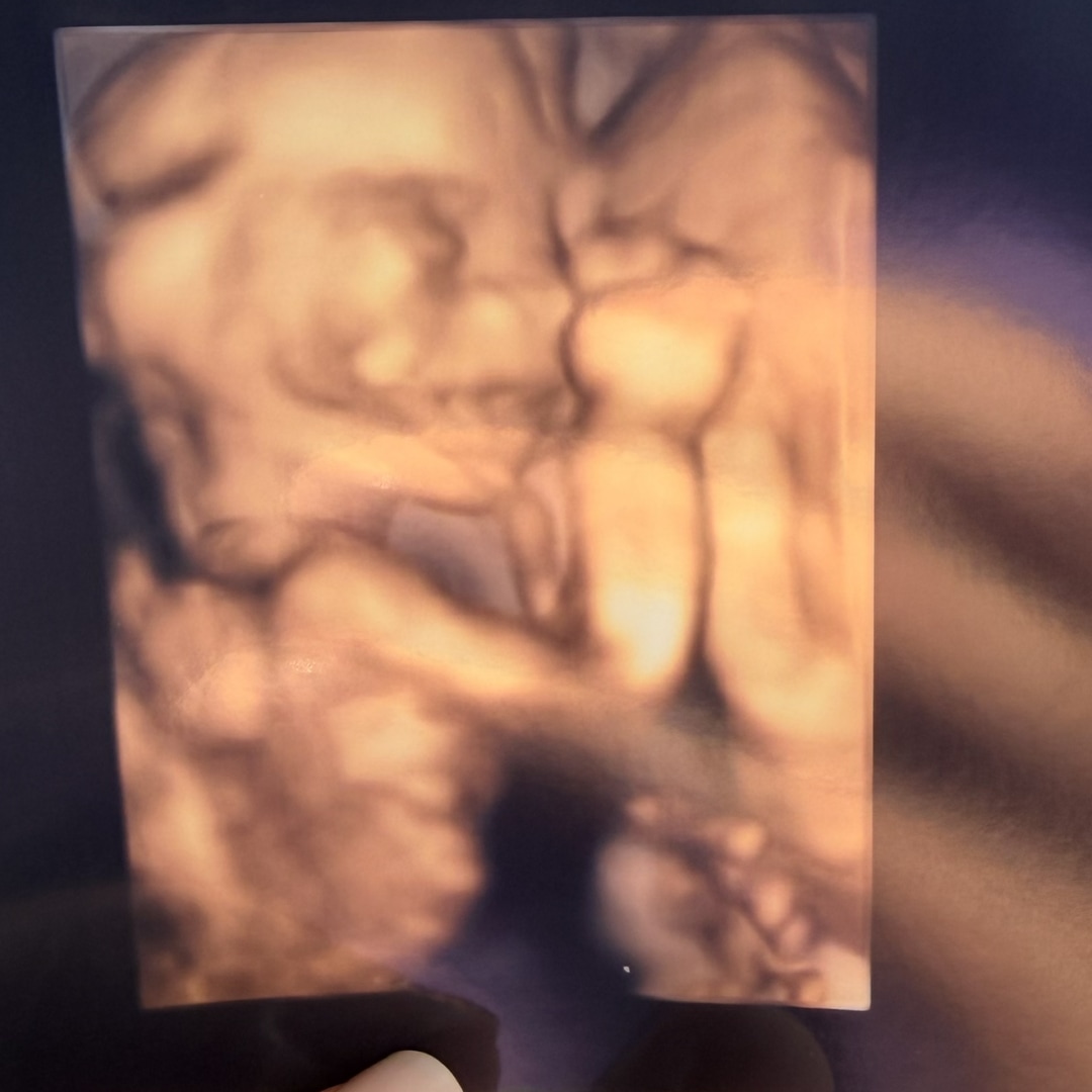 Photo shared by Amanda for their Babylist baby registry.