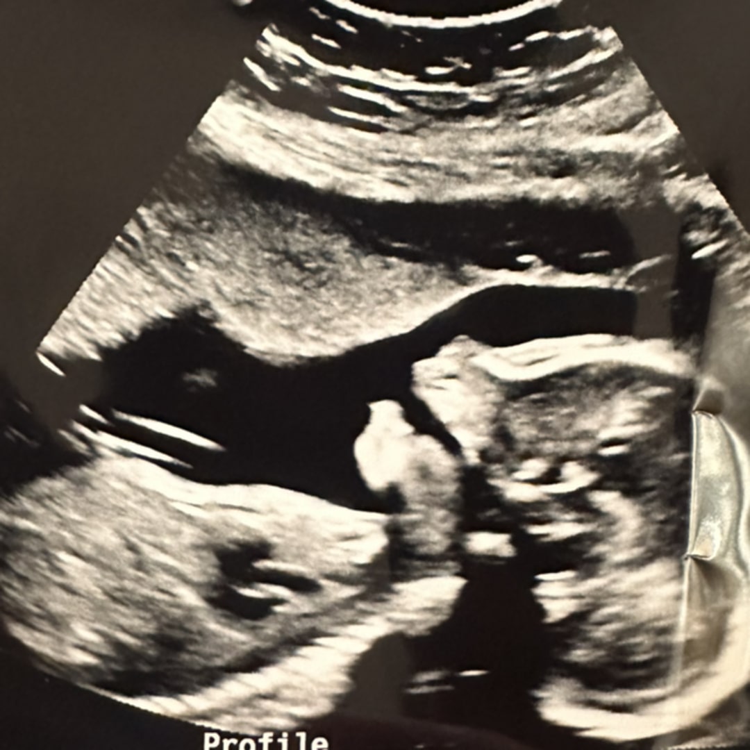 Photo shared by Megan for their Babylist baby registry.