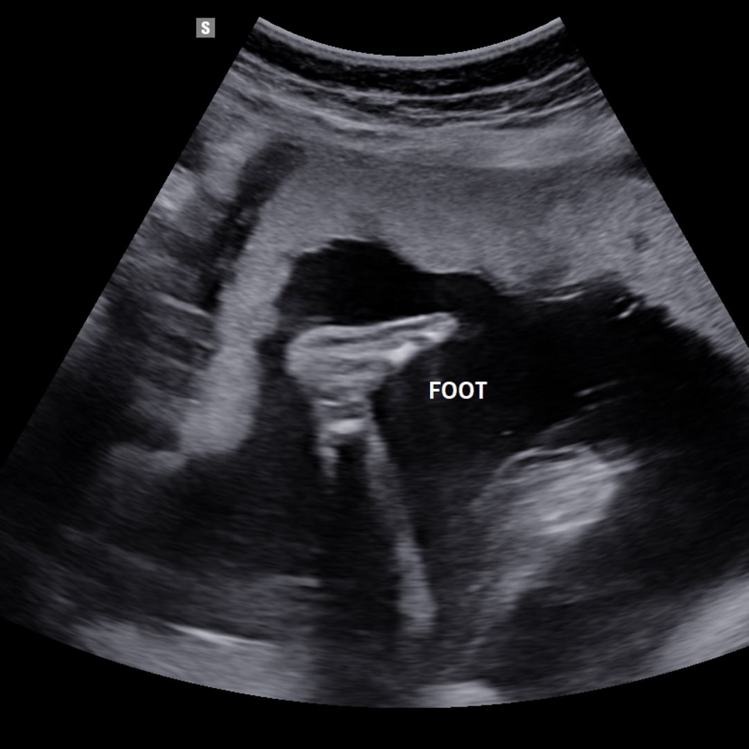 Photo shared by Aly for their Babylist baby registry.