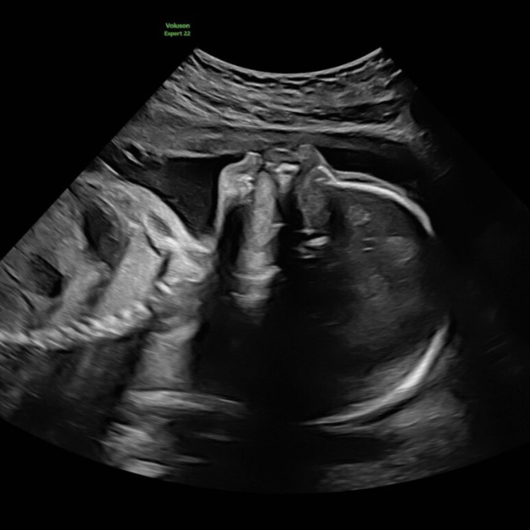 Photo shared by Olivia for their Babylist baby registry.