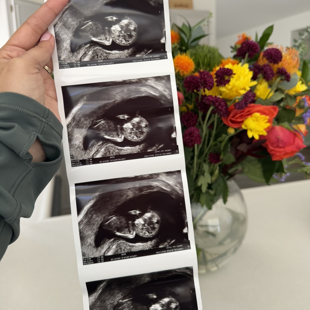 Photo shared by Alyssa for their Babylist baby registry.