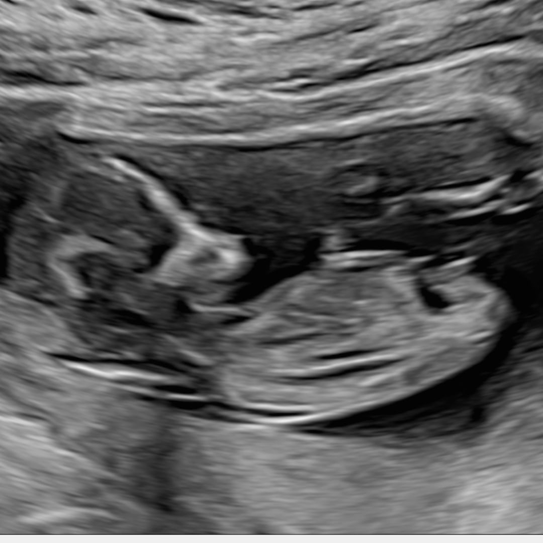 Photo shared by Abigail for their Babylist baby registry.
