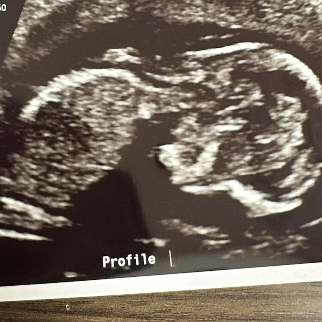 Photo shared by Leslie for their Babylist baby registry.