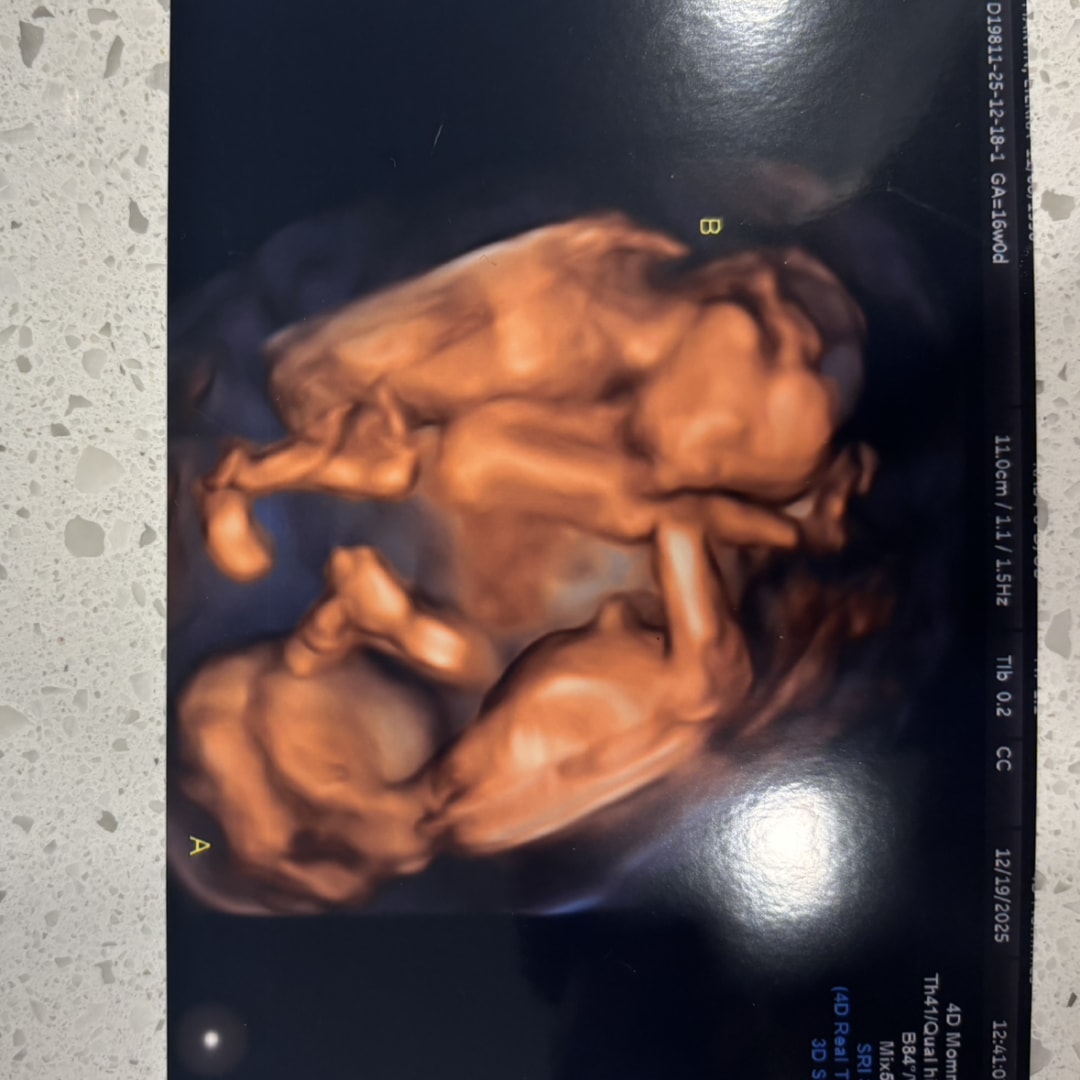 Photo shared by Lierra for their Babylist baby registry.