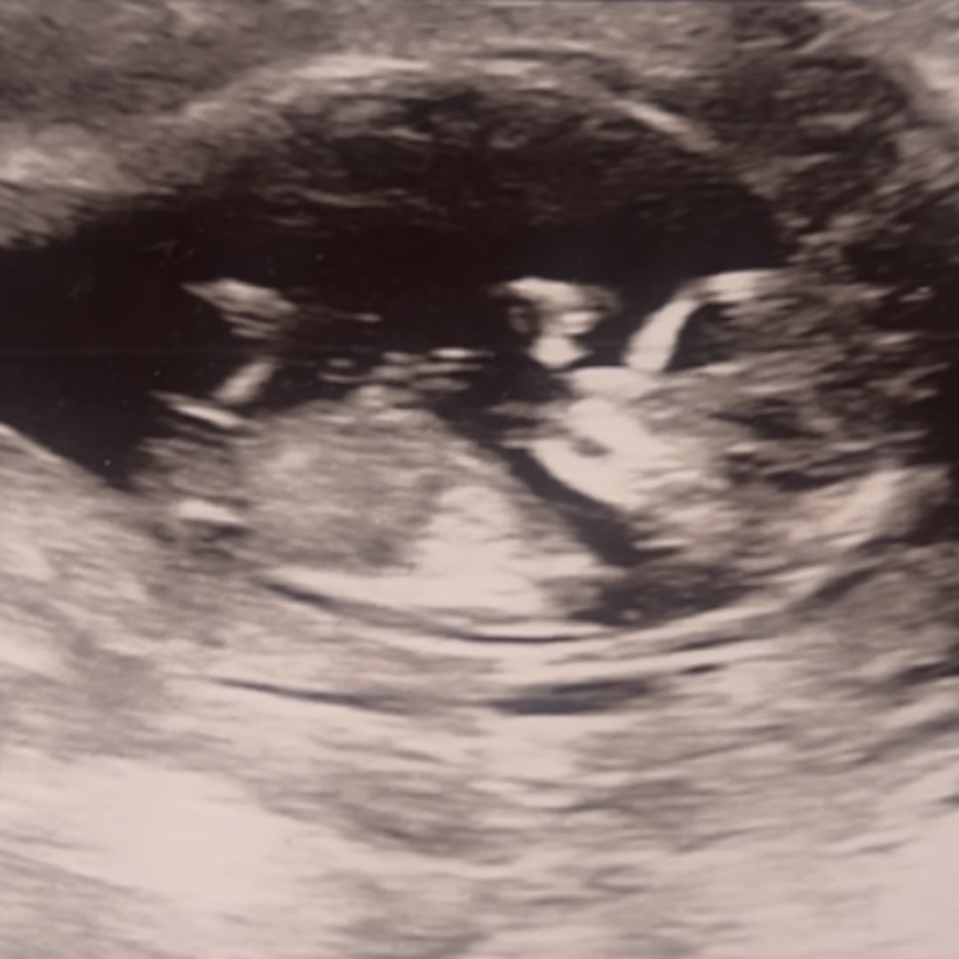 Photo shared by Jamie for their Babylist baby registry.