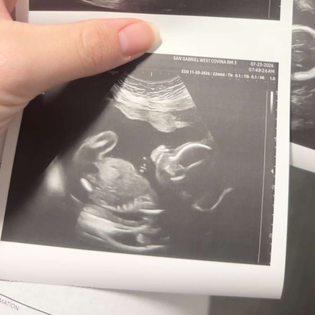 Photo shared by Melanie for their Babylist baby registry.