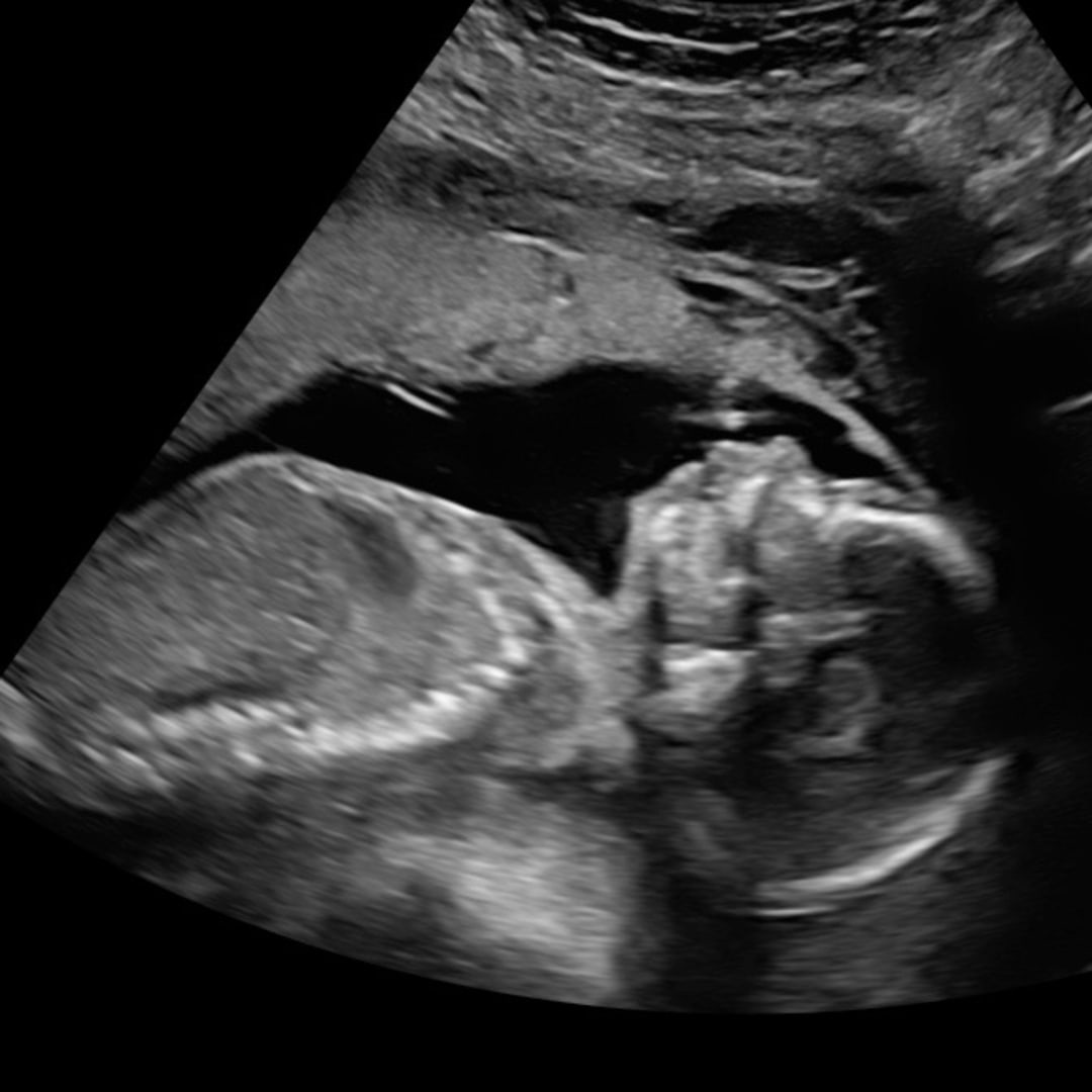 Photo shared by Tessa for their Babylist baby registry.