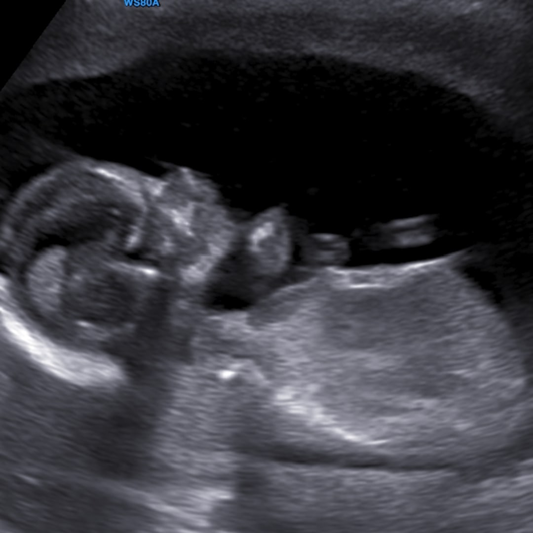 Photo shared by Megan for their Babylist baby registry.