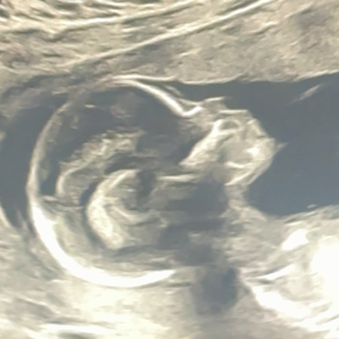 Photo shared by Amber for their Babylist baby registry.