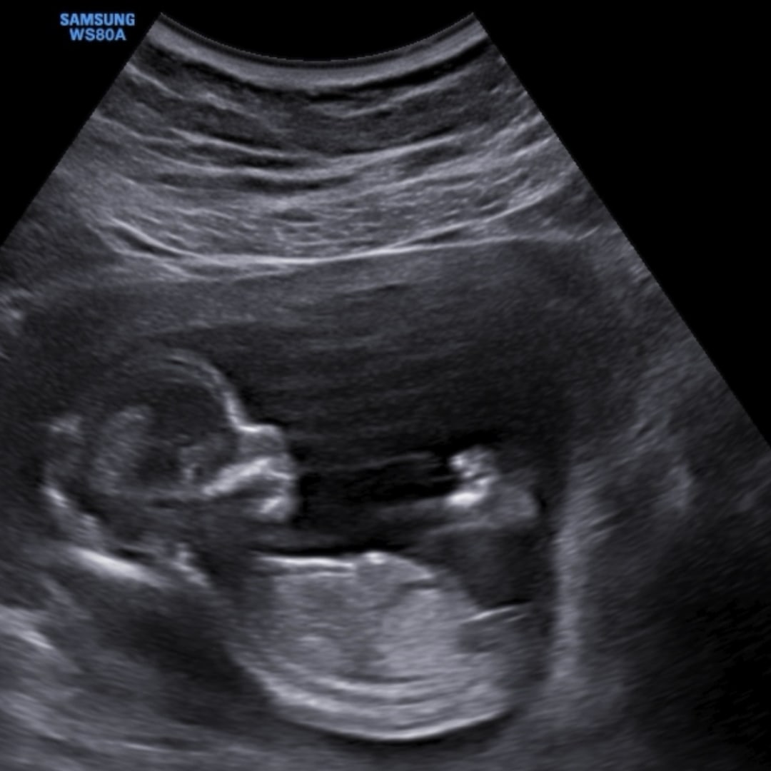 Photo shared by Hailey for their Babylist baby registry.