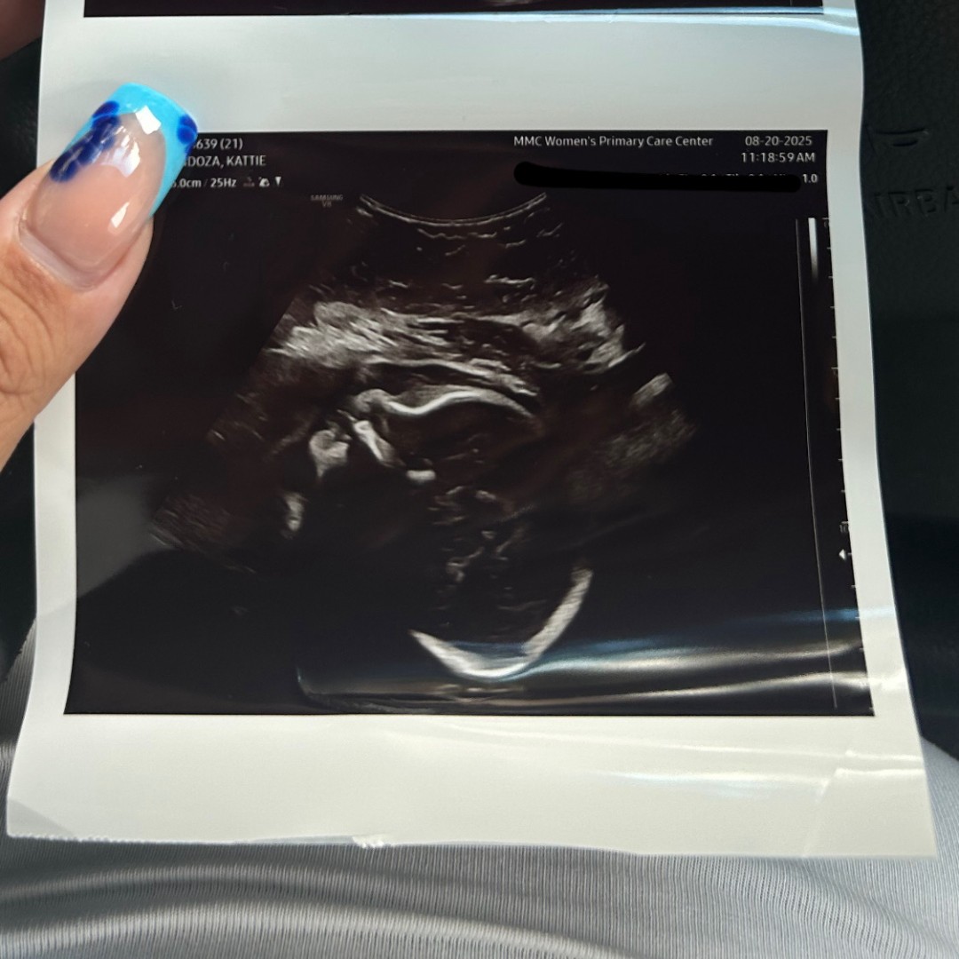 Photo shared by Kattie for their Babylist baby registry.