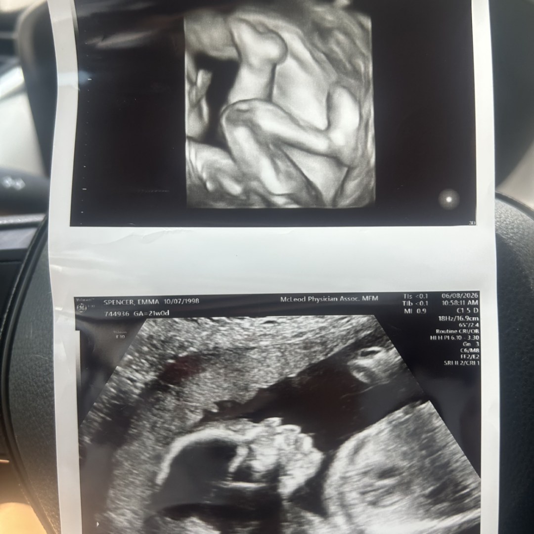 Photo shared by Emma for their Babylist baby registry.