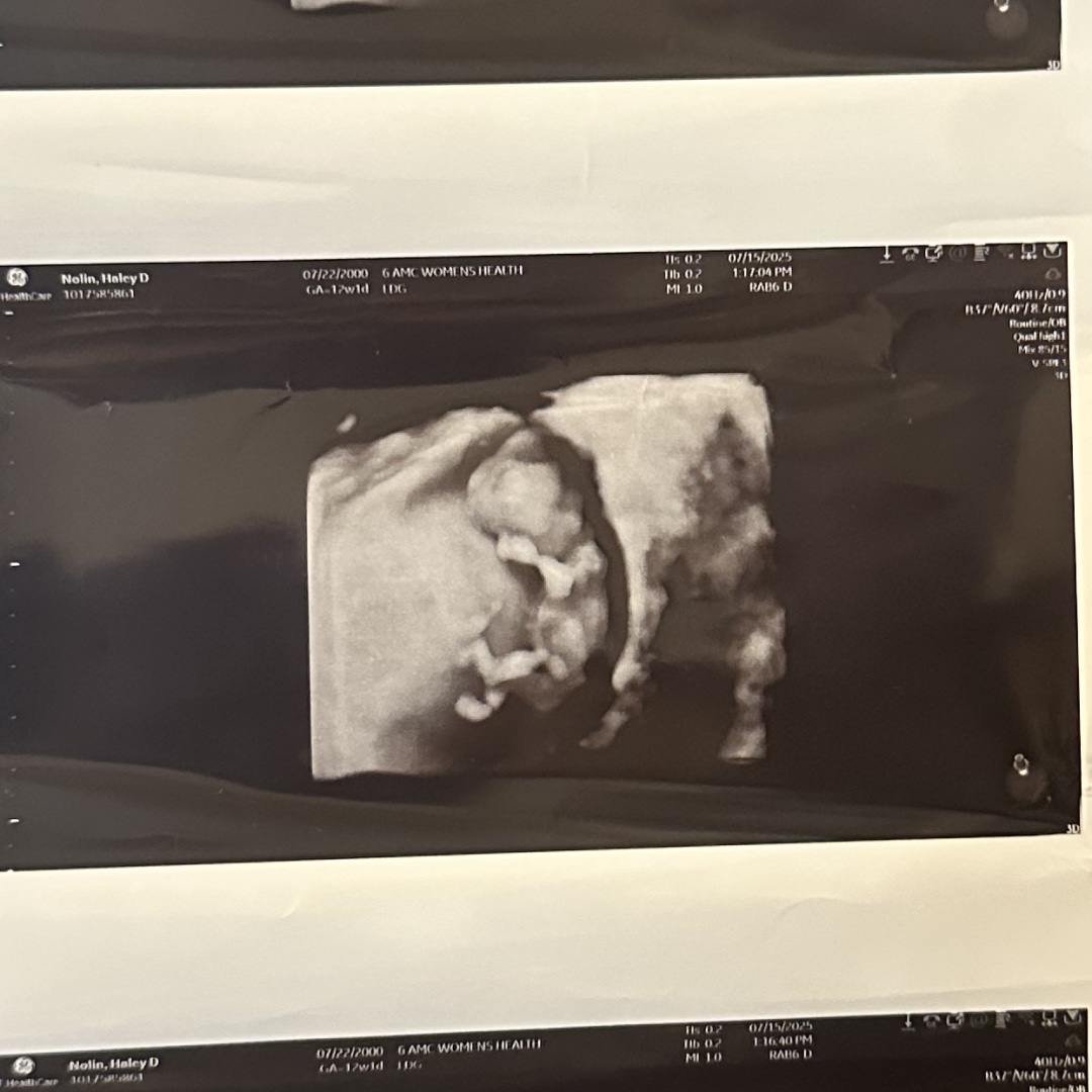 Photo shared by Haley for their Babylist baby registry.