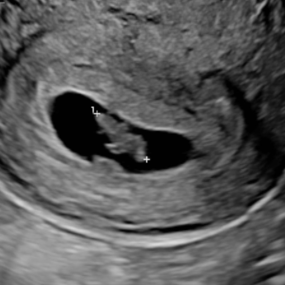 Photo shared by Alyssa for their Babylist baby registry.