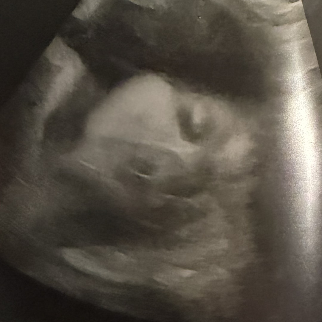 Photo shared by Christina for their Babylist baby registry.