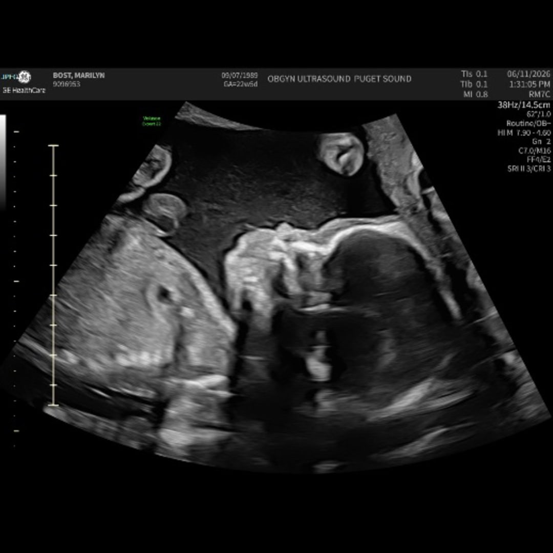 Photo shared by Jesse and Marilyn for their Babylist baby registry.