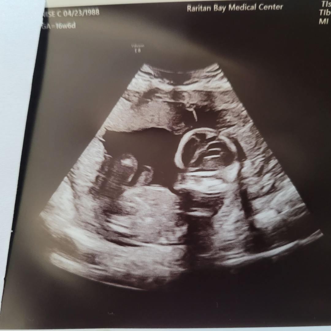 Photo shared by Denise for their Babylist baby registry.