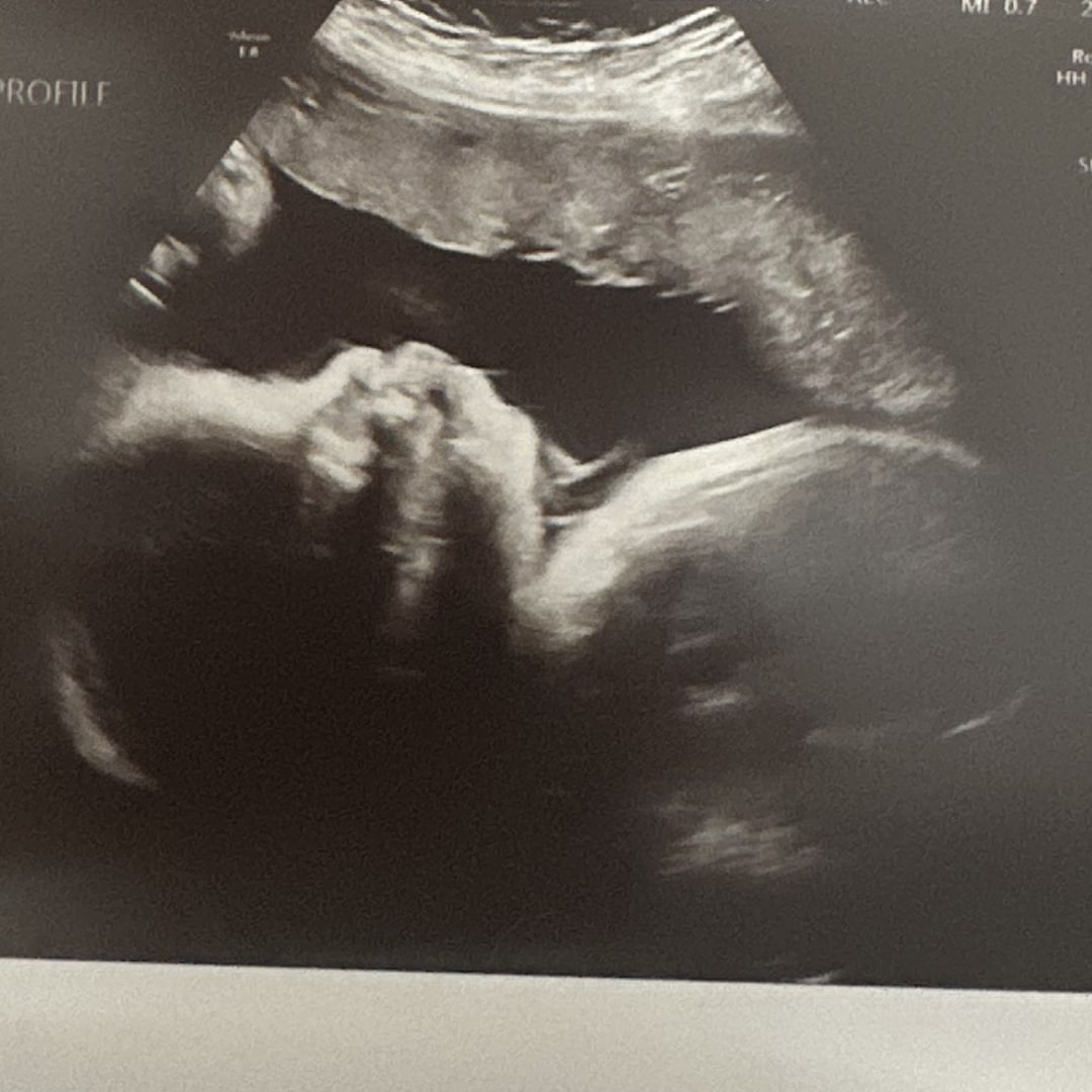 Photo shared by Kelley for their Babylist baby registry.