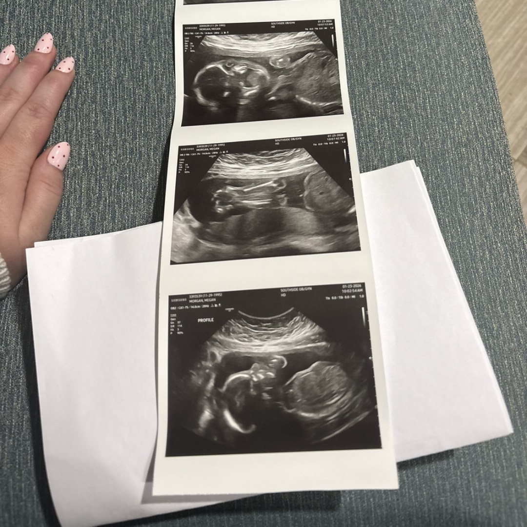 Photo shared by Megan for their Babylist baby registry.