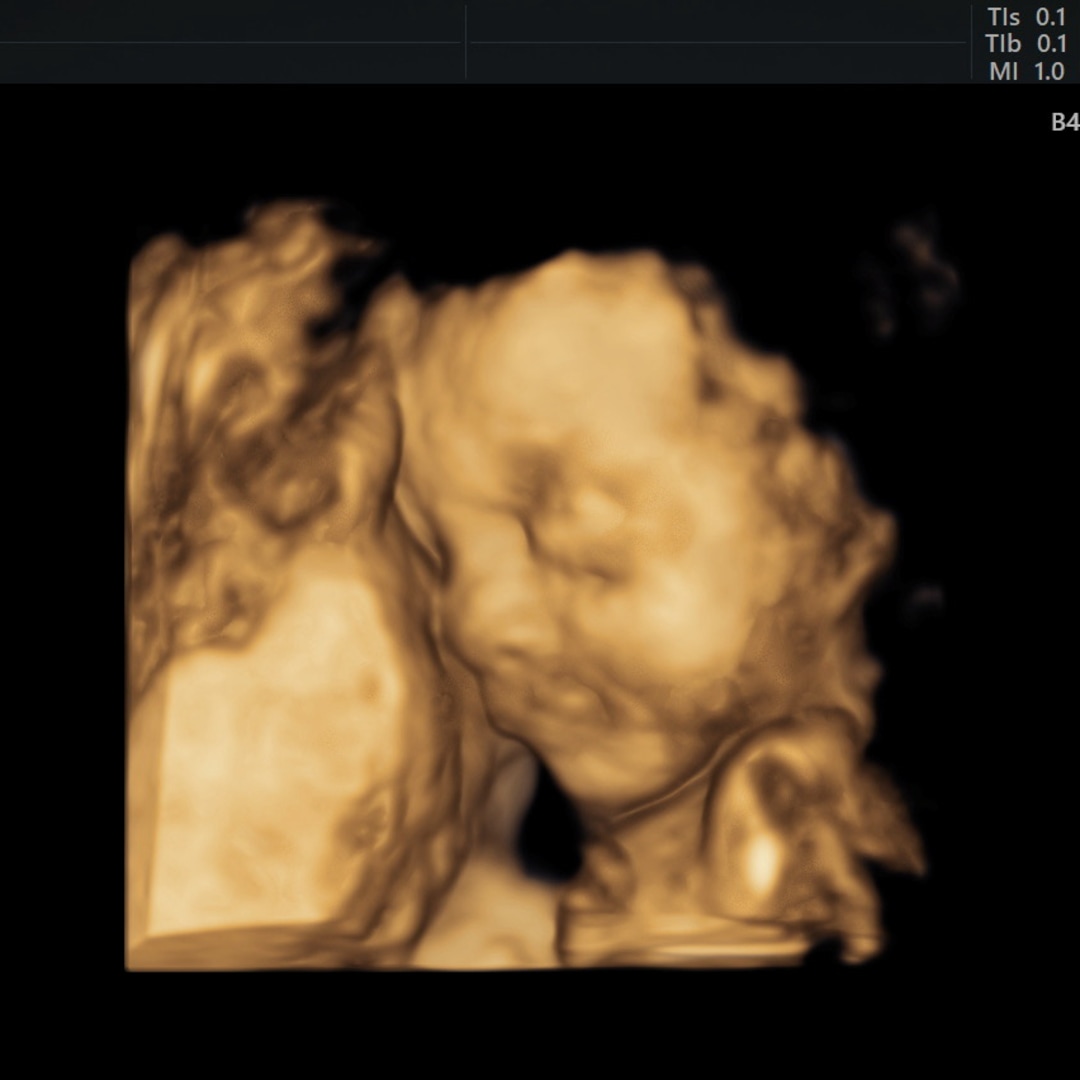 Photo shared by Lexee for their Babylist baby registry.