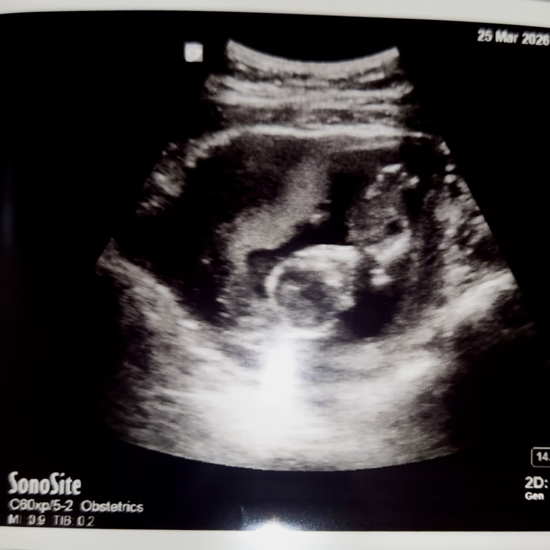 Photo shared by Jacqueline for their Babylist baby registry.