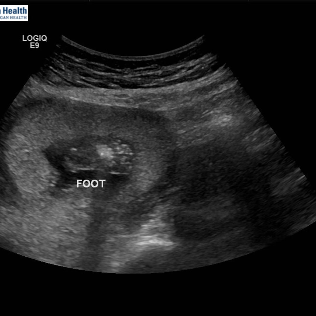 Photo shared by Erin for their Babylist baby registry.