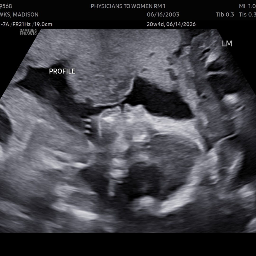 Photo shared by Madison for their Babylist baby registry.