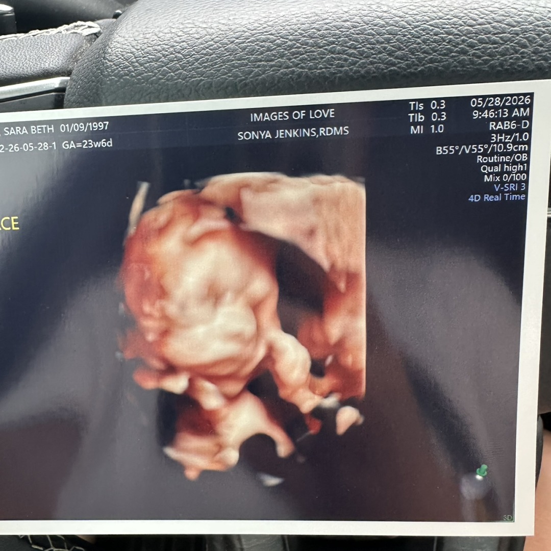 Photo shared by Sara Beth for their Babylist baby registry.