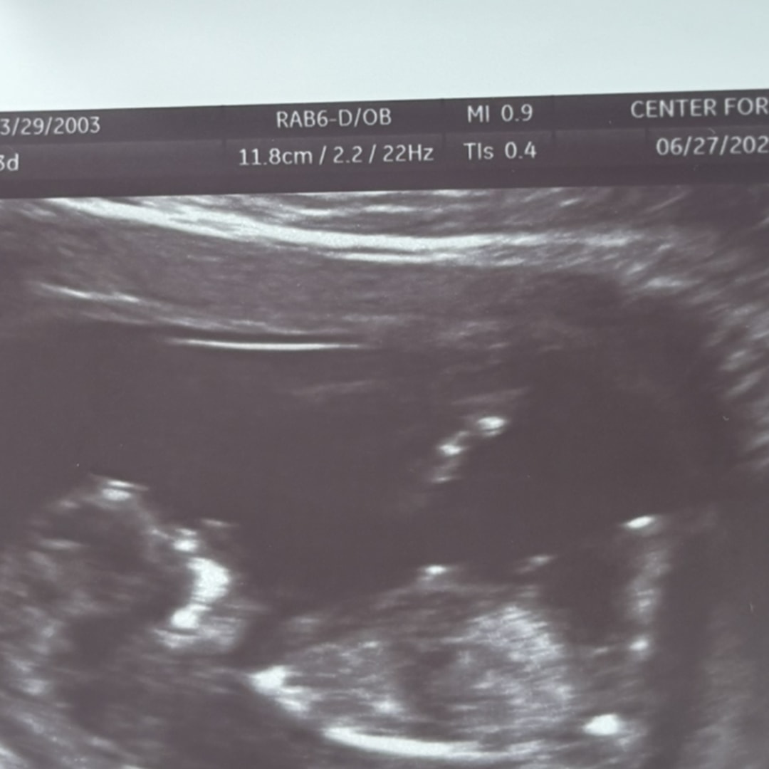 Photo shared by Hayley for their Babylist baby registry.