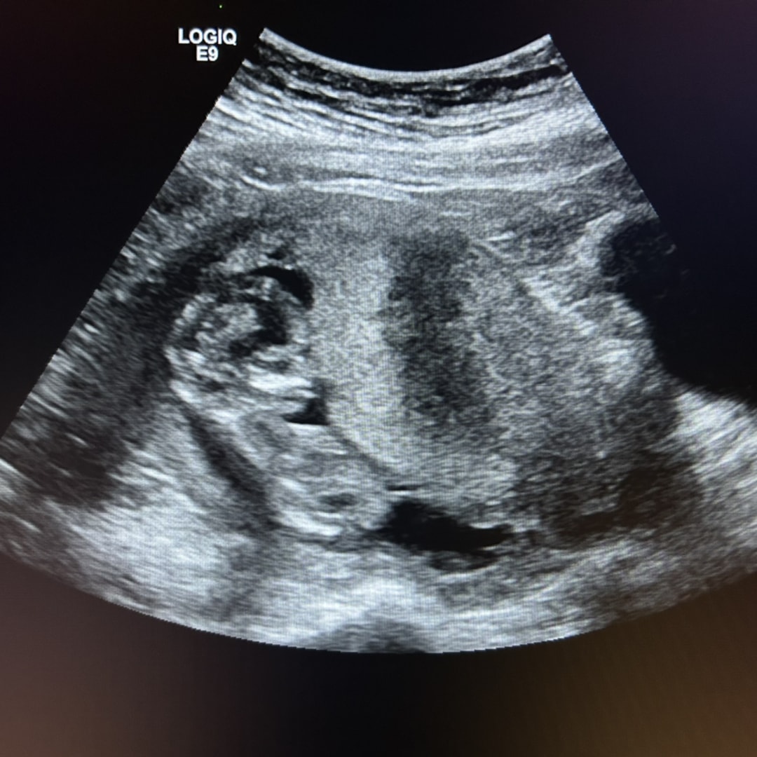 Photo shared by Alyssa for their Babylist baby registry.