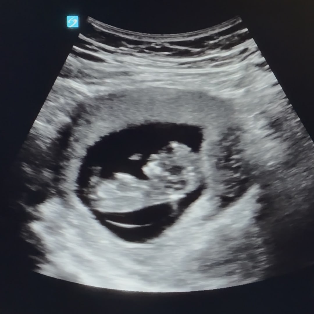 Photo shared by Jaylin for their Babylist baby registry.