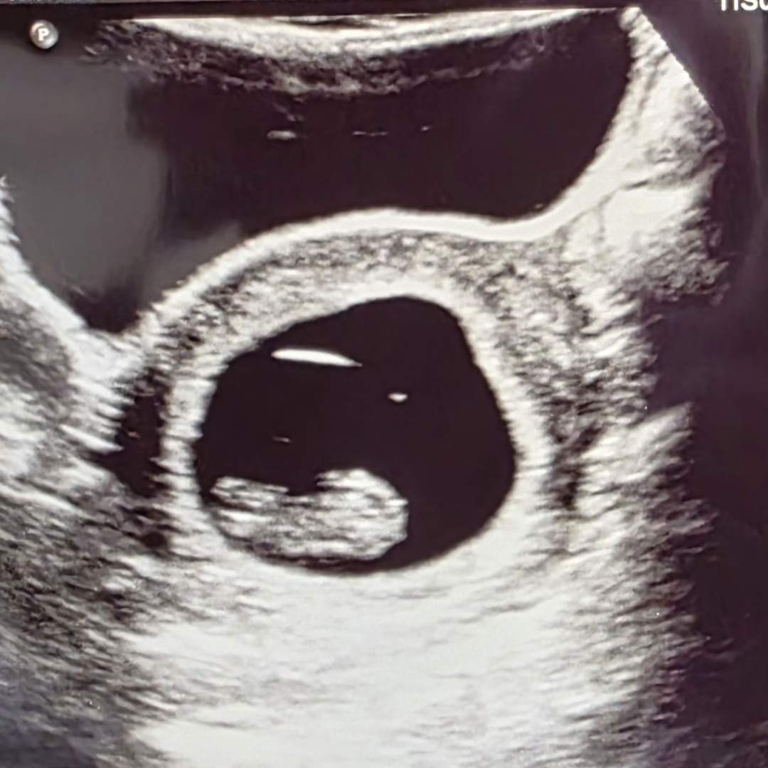 Photo shared by Chanel for their Babylist baby registry.