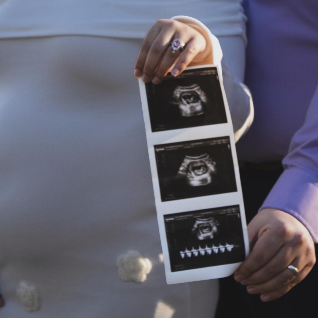 Photo shared by Isavira for their Babylist baby registry.