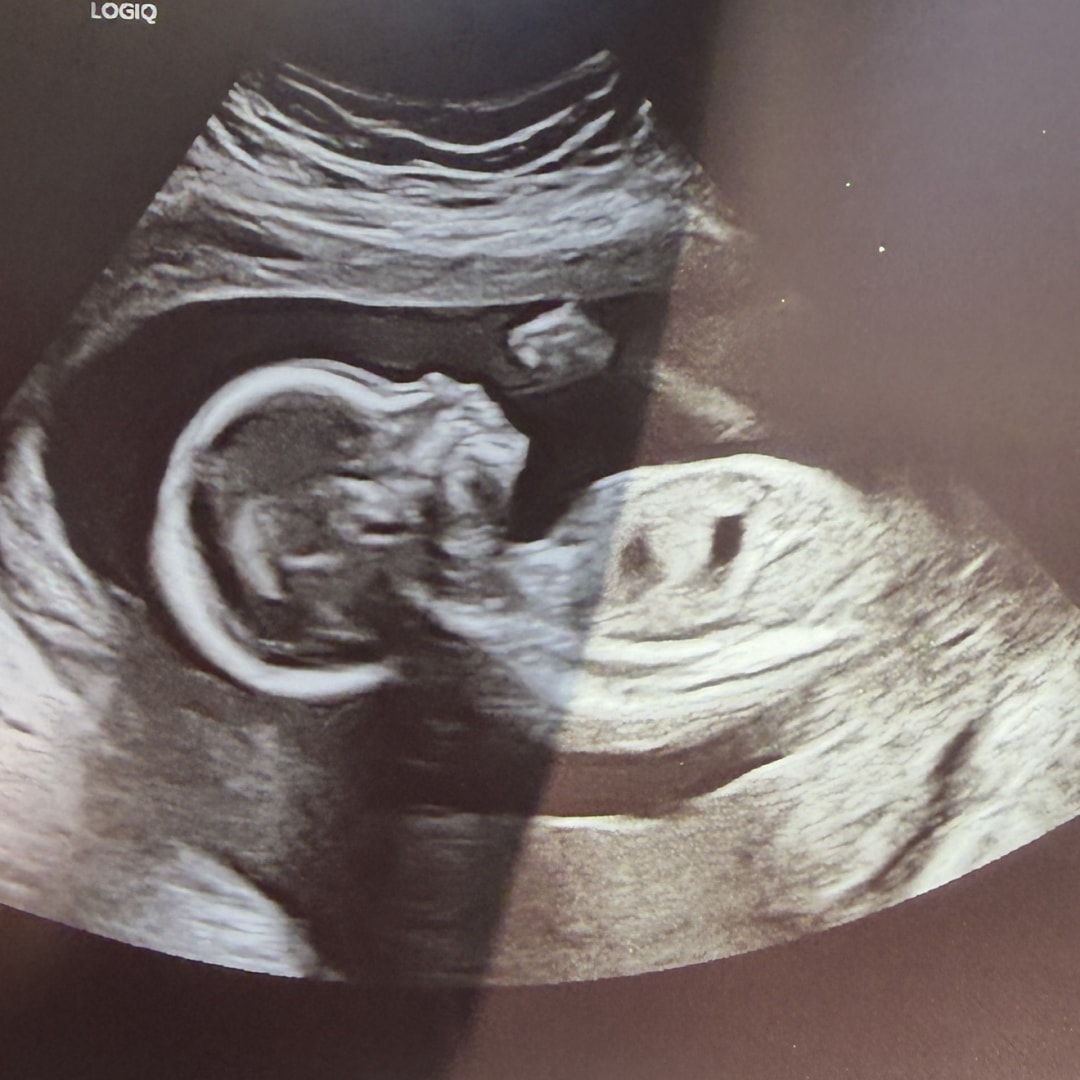 Photo shared by Eve for their Babylist baby registry.