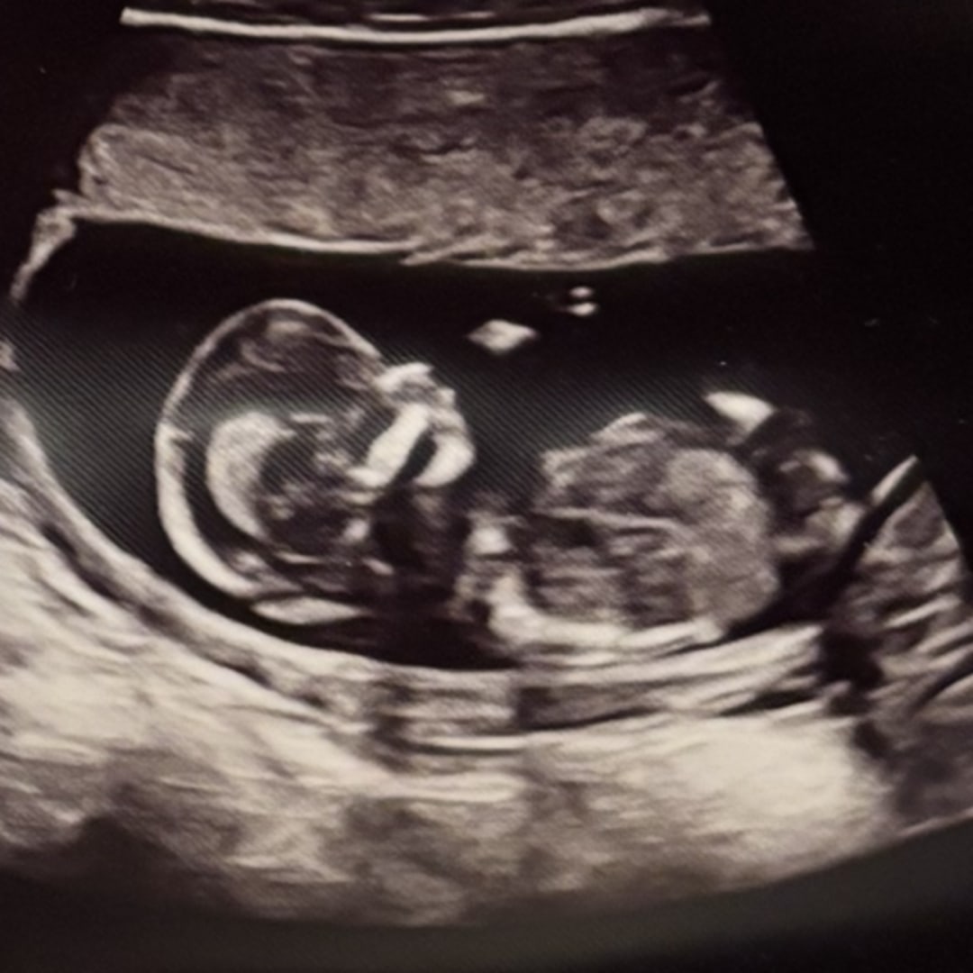 Photo shared by Samantha for their Babylist baby registry.