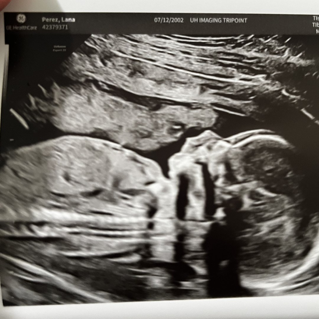 Photo shared by Lana for their Babylist baby registry.