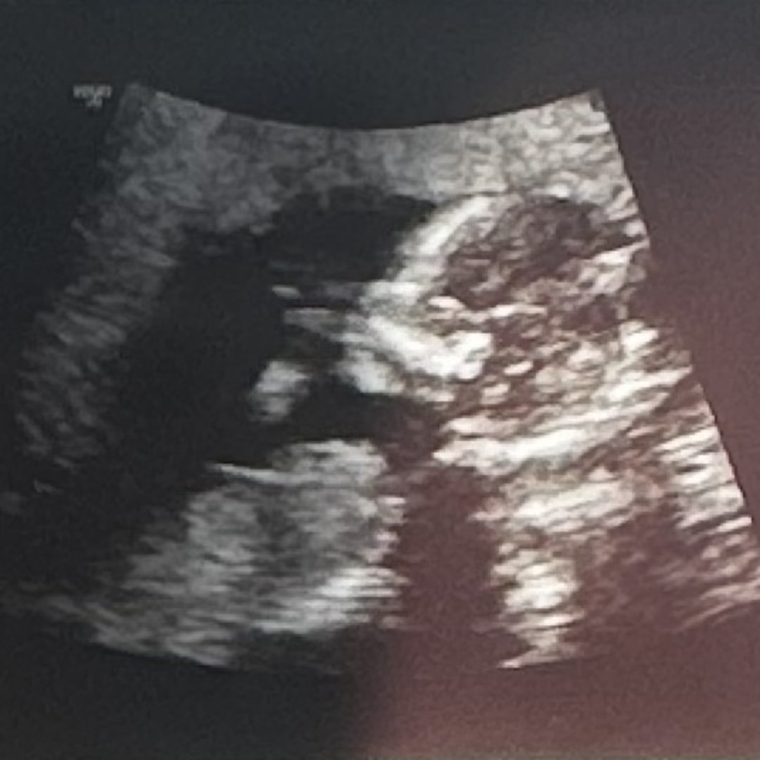 Photo shared by Aaliyah for their Babylist baby registry.